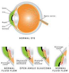 Glaucoma Jacksonville | Eye Exam Jacksonville, NC | Office Park Eye